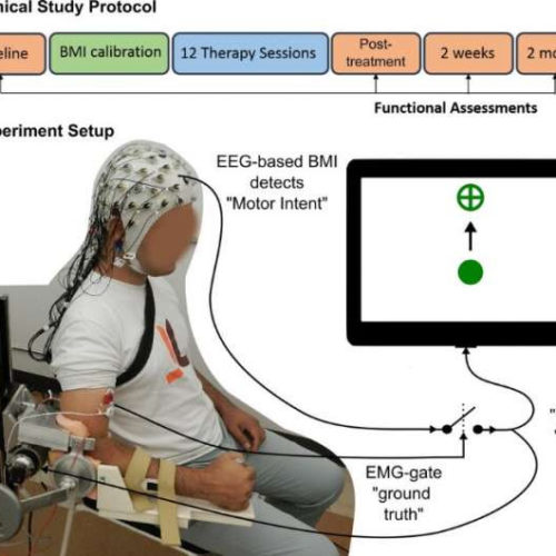 Tapping the brain to boost stroke rehabilitation