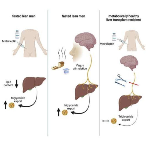 Hormone protects against development of fatty liver