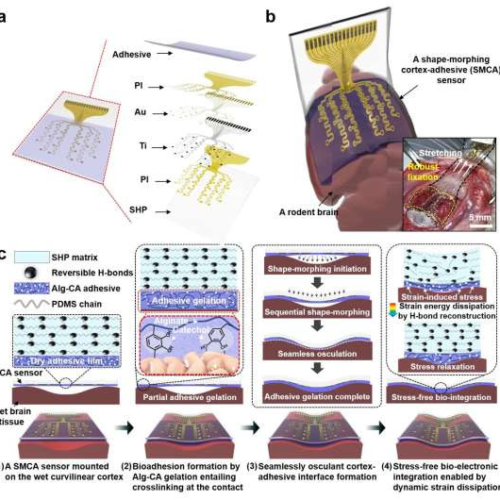 Adhesive cortical device enables artifact-free neuromodulation for closed-loop epilepsy treatment