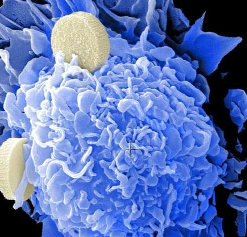 Small-molecule drug shows potential for hard to treat cancers